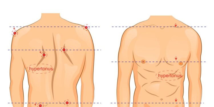 Escoliose - Créditos: depositphotos.com / Artemida-psy