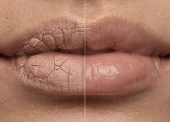 Os tipos de protetores labiais que mais funcionam e como identificar o que realmente recupera lábios rachados