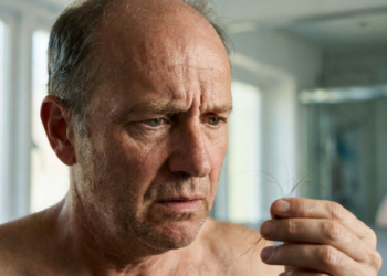 Percebeu entradas ou cabelo ralo? Veja o que fazer antes do pior acontecer