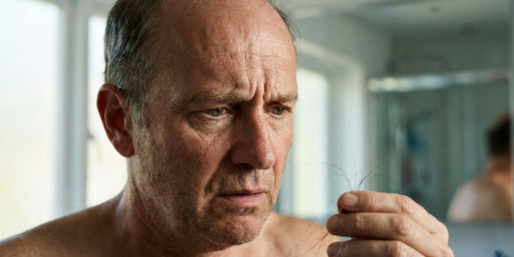 Percebeu entradas ou cabelo ralo? Veja o que fazer antes do pior acontecer