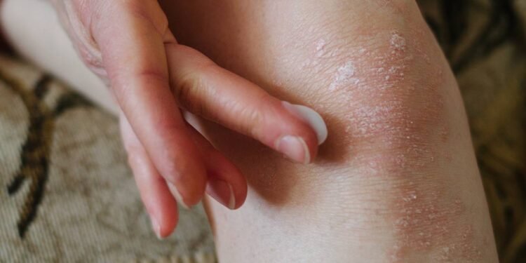 No dia a dia, alguns hábitos simples exercem impacto direto na maciez da pele corporal - Créditos: depositphotos.com / KatherinePirs