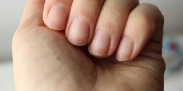 Cutículas ressecadas e doloridas? Conheça o poder do óleo de cravo para recuperar suas unhas