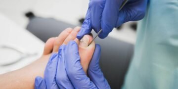 Dor, inchaço e pus na unha? Entenda como tratar a infecção e recuperar a saúde dos seus pés