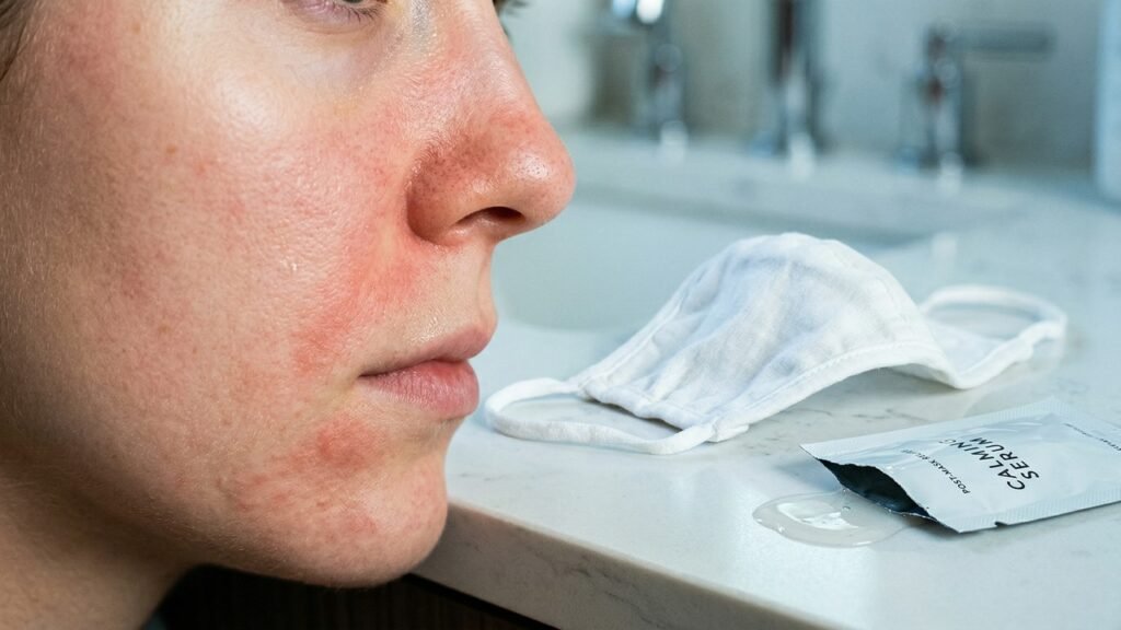 Máscaras faciais de tecido parecem inofensivas, mas esse erro comum pode causar irritação na pele