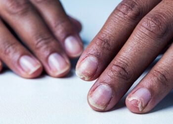 Como fortalecer unhas quebradiças com uma base simples que você pode fazer em casa em poucos minutos