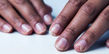 Como fortalecer unhas quebradiças com uma base simples que você pode fazer em casa em poucos minutos
