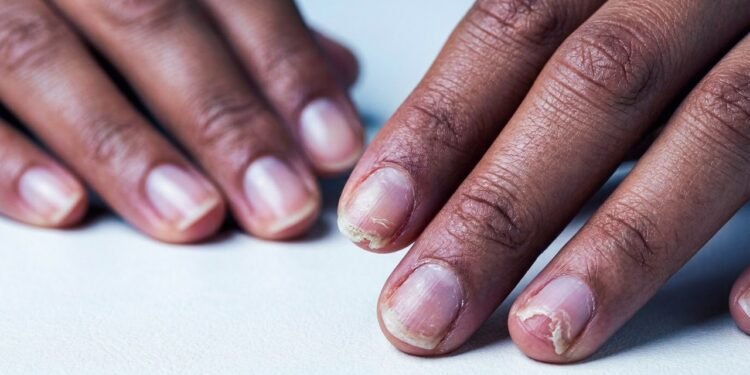 Como fortalecer unhas quebradiças com uma base simples que você pode fazer em casa em poucos minutos