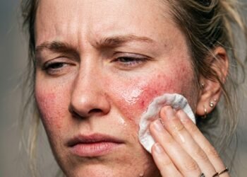 Muita gente usa esse produto para cuidar da pele, mas poucos conhecem o perigo que estão correndo