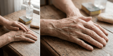 Mãos com aspecto de papel? Conheça as causas e aprenda a fazer uma máscara nutritiva poderosa