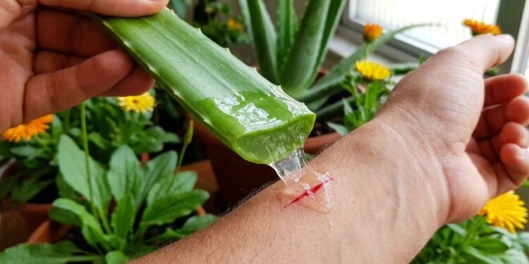 A babosa, ou Aloe vera, é famosa pelo gel transparente dentro de suas folhas, usado há anos para cuidar de feridas leves