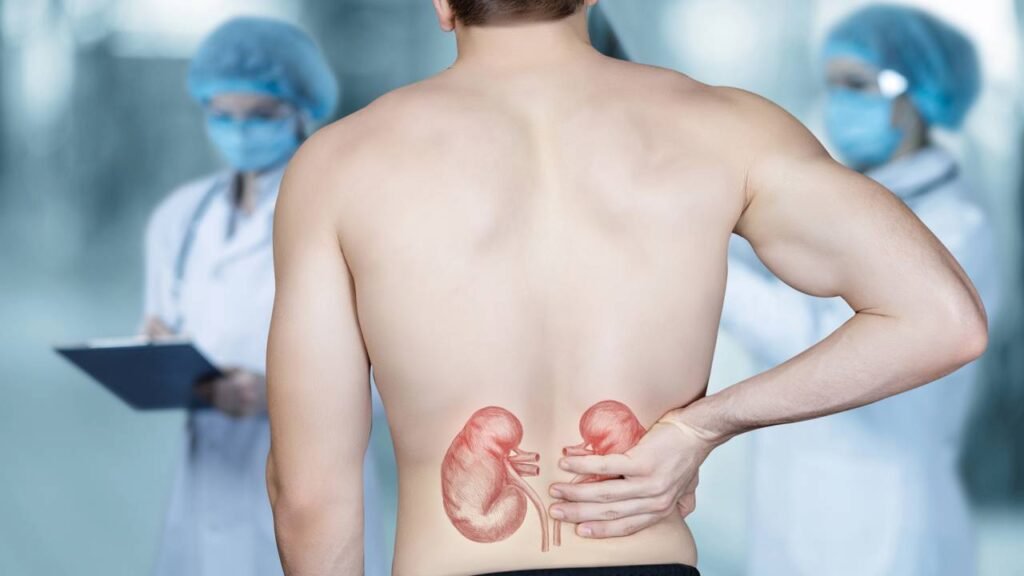evitar cálculo renal