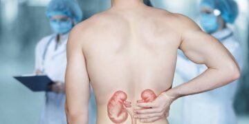 evitar cálculo renal