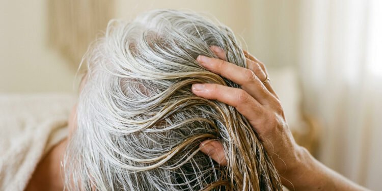 Como se livrar dos cabelos brancos em 10 minutos com um remédio caseiro simples: basta usar as cascas de frutas cozidas