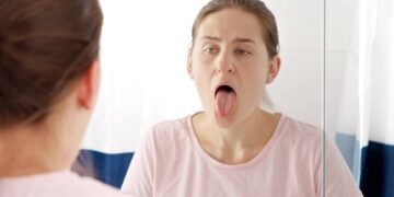 Língua esbranquiçada ao acordar: o sinal do corpo que muita gente ignora