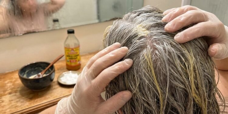 Aplicar vinagre e bicarbonato de sódio nos cabelos branco: como fazer corretamente e para que serve