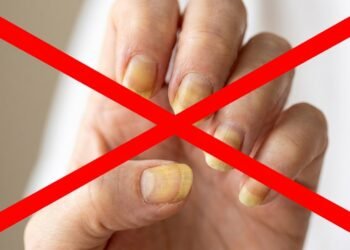 Adeus unhas amareladas, a mistura de limão que virou tendência para clarear as mãos em casa