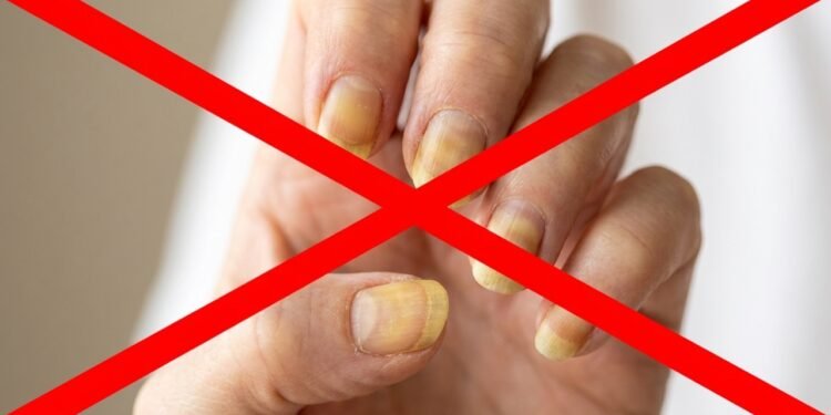 Adeus unhas amareladas, a mistura de limão que virou tendência para clarear as mãos em casa