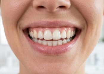 Estas mudanças na rotina matinal garantem uma saúde bucal perfeita e evitam cáries em adultos