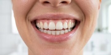 Estas mudanças na rotina matinal garantem uma saúde bucal perfeita e evitam cáries em adultos