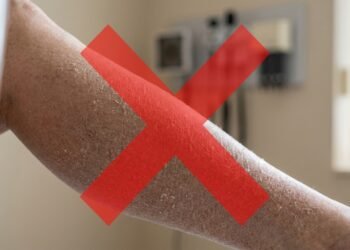 Adeus as pernas ressecadas, o truque simples para salvar sua pele no outono e inverno