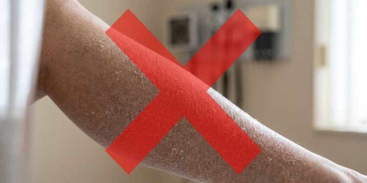 Adeus as pernas ressecadas, o truque simples para salvar sua pele no outono e inverno