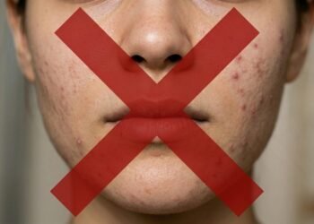 Adeus as espinhas depois dos 30, o impacto da esfoliação no tratamento da acne e renovação da pele