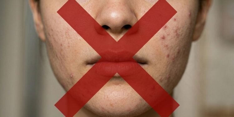 Adeus as espinhas depois dos 30, o impacto da esfoliação no tratamento da acne e renovação da pele