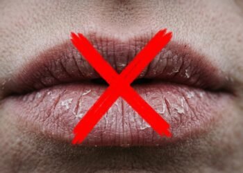 Adeus aos lábios rachados no inverno, os cuidados simples que evitam fissuras e sangramentos no frio