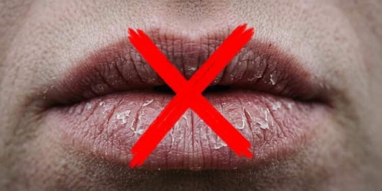 Adeus aos lábios rachados no inverno, os cuidados simples que evitam fissuras e sangramentos no frio