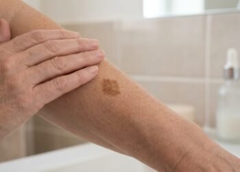 Adeus manchas de sol, o extrato natural que devolve o brilho e a elasticidade para mulheres 40+