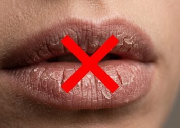 Adeus lábios rachados e doloridos, a rotina de cuidados simples que virou a nova tendência para o tempo seco