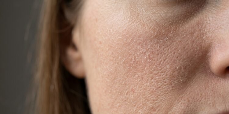 Mistura caseira para pele extremamente seca que vai recuperar o brilho natural