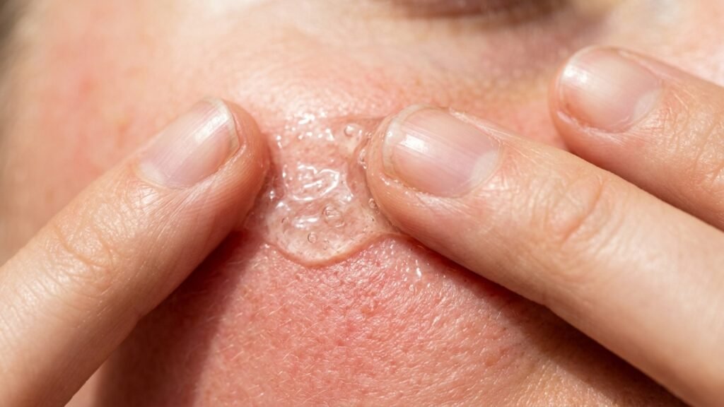 O truque da babosa para acalmar a pele e evitar a vermelhidão com um hábito simples