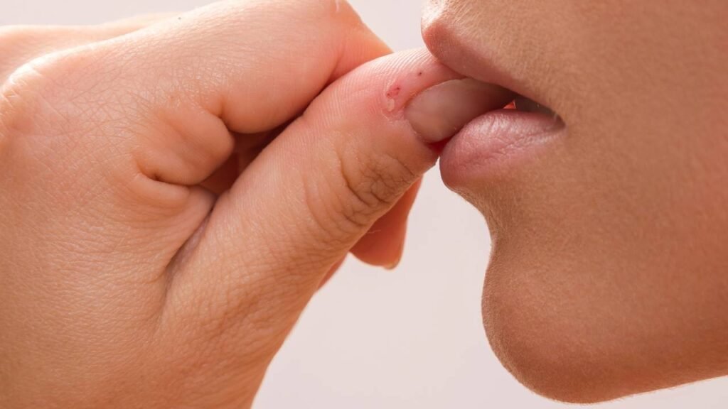 como parar de roer unhas