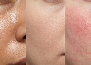 Quais produtos de limpeza você deve usar de acordo com o seu tipo de pele