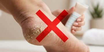 Adeus ao calcanhar rachado: essa hidratação pode acabar com o ressecamento sem precisar de lixa