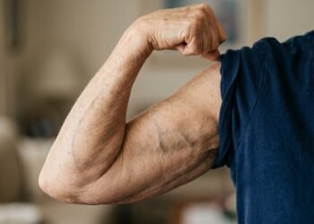 Mulheres acima dos 60 anos podem precisar de mais do que caminhada para manter ossos fortes