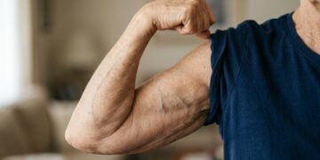 Mulheres acima dos 60 anos podem precisar de mais do que caminhada para manter ossos fortes