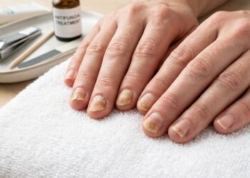 Nem pomadas caras nem tratamentos químicos, o hábito simples no banho que protege suas unhas de fungos