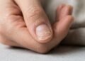 Adeus unhas quebradiças: a receita com cravo na base que promete fortalecer desde a raiz