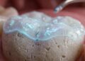 Hábito de enxaguar a boca após escovação pode prejudicar os dentes