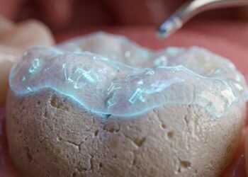Hábito de enxaguar a boca após escovação pode prejudicar os dentes