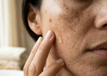 Manchas na pele: a rotina diária que ajuda a corrigir e a prevenir o seu reaparecimento