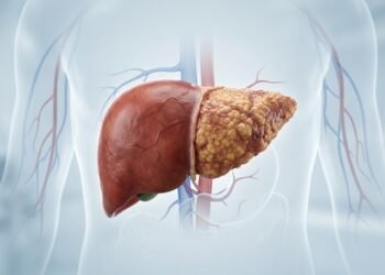 Cirrose hepática mostra como a cicatrização do fígado pode evoluir para doença grave silenciosa