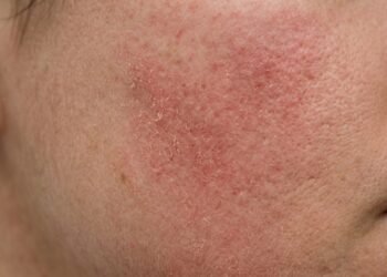 Dermatologista explica de que forma você pode estar machucando sua pele na hora de lavar
