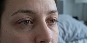 Especialista explica por que acordar cansado nem sempre está relacionado à falta de sono