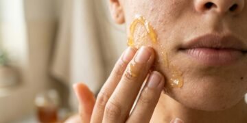 “Mel, Acne e a Verdade Que Ninguém Conta: 5 Máscaras Simples Que Transformam Sua Pele (Sem Promessas Milagrosas)”