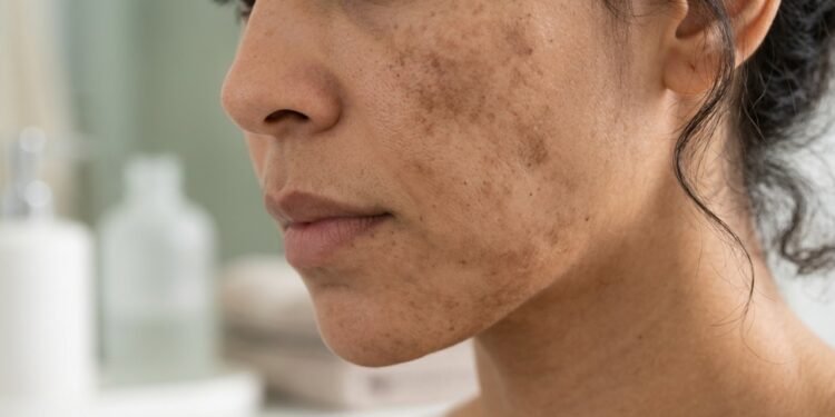 Dermatologistas revelam a rotina que ajuda a evitar manchas e uniformizar a pele o ano inteiro