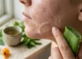 As plantas campeãs em cuidados com acne e limpeza da pele