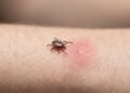 Como se proteger da doença de Lyme, transmitida por carrapatos e que está em ascensão